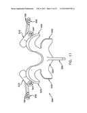 Prothesis For the Replacement of a Posterior Element of a Vertebra diagram and image