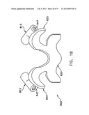 Prothesis For the Replacement of a Posterior Element of a Vertebra diagram and image