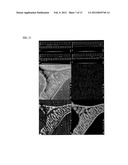 BIODEGRADABLE IMPLANT AND METHOD FOR MANUFACTURING SAME diagram and image