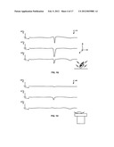 Activating Applications Based on Accelerometer Data diagram and image