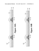 Apparel Incorporating Tensile Strands diagram and image