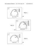 METHOD AND SYSTEM FOR SIZING AN ORAL DEVICE diagram and image