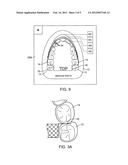 METHOD AND SYSTEM FOR SIZING AN ORAL DEVICE diagram and image