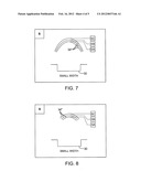 METHOD AND SYSTEM FOR SIZING AN ORAL DEVICE diagram and image