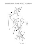 Brake Disc Pot for Motor Vehicles diagram and image