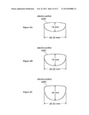 Static Progressive Surface Region In Optical Communication With A Dynamic     Optic diagram and image