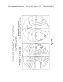 Static Progressive Surface Region In Optical Communication With A Dynamic     Optic diagram and image