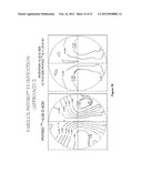 Static Progressive Surface Region In Optical Communication With A Dynamic     Optic diagram and image