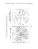 Static Progressive Surface Region In Optical Communication With A Dynamic     Optic diagram and image