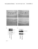 IDENTIFICATION OF EXTRACELLULAR FORM OF PTEN THAT CAN BE USED TO TREAT     TUMORS diagram and image