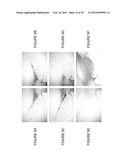 USE OF APOPTOSIS INHIBITING COMPOUNDS IN DEGENERATIVE NEUROLOGICAL     DISORDERS diagram and image