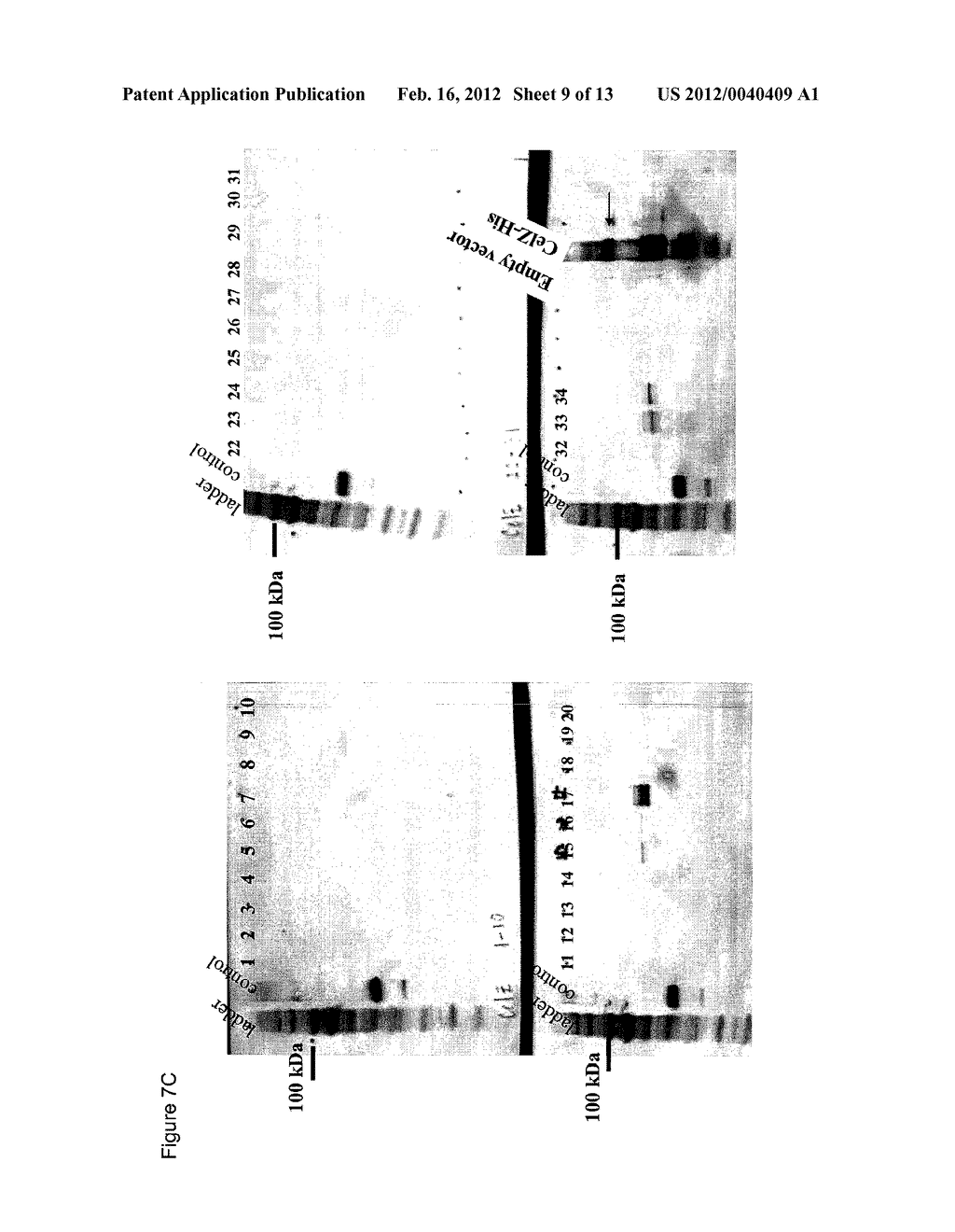 Heterologous Biomass Degrading Enzyme Expression in Thermoanaerobacterium     Saccharolyticum - diagram, schematic, and image 10