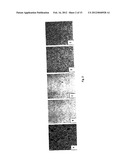 METHODS AND COMPOSITIONS FOR INHIBITING CELLULAR PROLIFERATION AND     SURGICAL ADHESION diagram and image