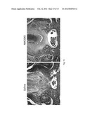 METHODS AND COMPOSITIONS FOR INHIBITING CELLULAR PROLIFERATION AND     SURGICAL ADHESION diagram and image