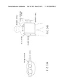 MR IMAGING PROVIDING TISSUE/BLOOD CONTRAST IMAGE diagram and image