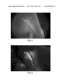 LIGHT-EMITTING DYE FOR INTRAOPERATIVE IMAGING OR SENTINEL LYMPH  NODE     BIOPSY diagram and image