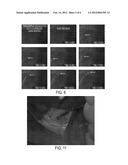 LIGHT-EMITTING DYE FOR INTRAOPERATIVE IMAGING OR SENTINEL LYMPH  NODE     BIOPSY diagram and image