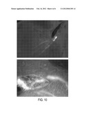 LIGHT-EMITTING DYE FOR INTRAOPERATIVE IMAGING OR SENTINEL LYMPH  NODE     BIOPSY diagram and image