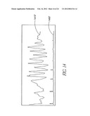 PULSE AND CONFIDENCE INDICATOR DISPLAYED PROXIMATE PLETHYSMOGRAPH diagram and image