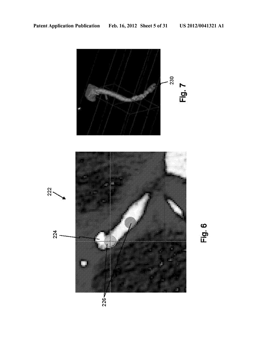 METHOD AND SYSTEM FOR PATIENT-SPECIFIC MODELING OF BLOOD FLOW - diagram, schematic, and image 06