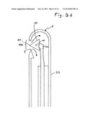 One-Hand Device for Ophthalmic Surgery diagram and image