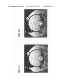 OPTIMIZED INTRACRANIAL CATHETERS FOR CONVECTION-ENHANCED DELIVERY OF     THERAPEUTICS diagram and image