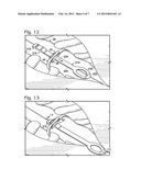 CABLE TIE SYSTEM FOR STABILIZING BONE diagram and image