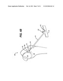 TUNNEL NOTCHER AND GUIDEWIRE DELIVERY DEVICE diagram and image