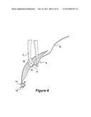 SURGICAL INSTRUMENT AND METHOD diagram and image