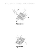 SURGICAL INSTRUMENT AND METHOD diagram and image