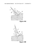 SURGICAL INSTRUMENT AND METHOD diagram and image