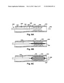 METHOD AND APPARATUS FOR INCREASING BLOOD FLOW THROUGH AN OBSTRUCTED BLOOD     VESSEL diagram and image