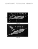 DEVICES AND METHODS FOR TREATING GASTROINTESTINAL AND METABOLIC DISORDERS diagram and image