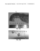 DEVICES AND METHODS FOR TREATING GASTROINTESTINAL AND METABOLIC DISORDERS diagram and image