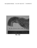 DEVICES AND METHODS FOR TREATING GASTROINTESTINAL AND METABOLIC DISORDERS diagram and image