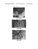 DEVICES AND METHODS FOR TREATING GASTROINTESTINAL AND METABOLIC DISORDERS diagram and image