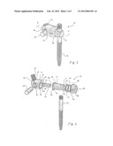 Variable Angle Connection Assembly diagram and image