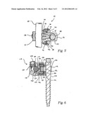 Variable Angle Connection Assembly diagram and image