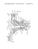 WIRELESS REMOTE DEVICE FOR A HEARING PROSTHESIS diagram and image