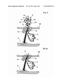 METHODS FOR TREATING SKIN CONDITIONS USING LASER diagram and image