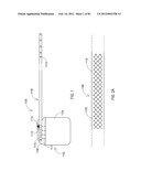 TERMINATION OF A SHIELD WITHIN AN IMPLANTABLE MEDICAL LEAD diagram and image