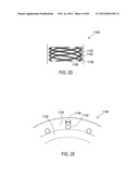 TERMINATION OF A SHIELD WITHIN AN IMPLANTABLE MEDICAL LEAD diagram and image