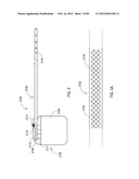 TERMINATION OF A SHIELD WITHIN AN IMPLANTABLE MEDICAL LEAD diagram and image