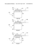 TERMINATION OF A SHIELD WITHIN AN IMPLANTABLE MEDICAL LEAD diagram and image