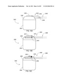 TERMINATION OF A SHIELD WITHIN AN IMPLANTABLE MEDICAL LEAD diagram and image