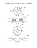 TERMINATION OF A SHIELD WITHIN AN IMPLANTABLE MEDICAL LEAD diagram and image