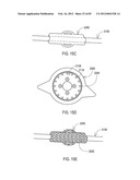 TERMINATION OF A SHIELD WITHIN AN IMPLANTABLE MEDICAL LEAD diagram and image