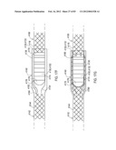 TERMINATION OF A SHIELD WITHIN AN IMPLANTABLE MEDICAL LEAD diagram and image