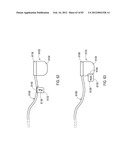 TERMINATION OF A SHIELD WITHIN AN IMPLANTABLE MEDICAL LEAD diagram and image