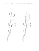 TERMINATION OF A SHIELD WITHIN AN IMPLANTABLE MEDICAL LEAD diagram and image